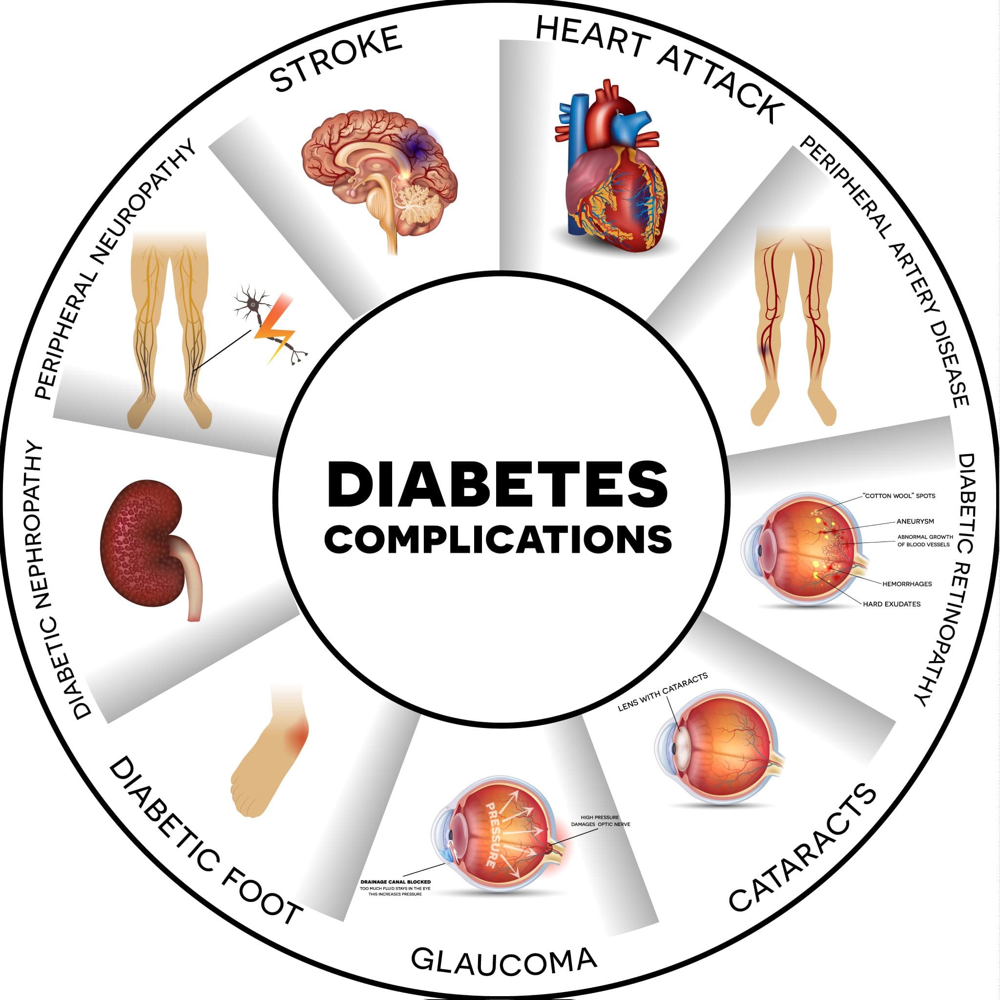 Diabetes Being the largest epidemic in human history